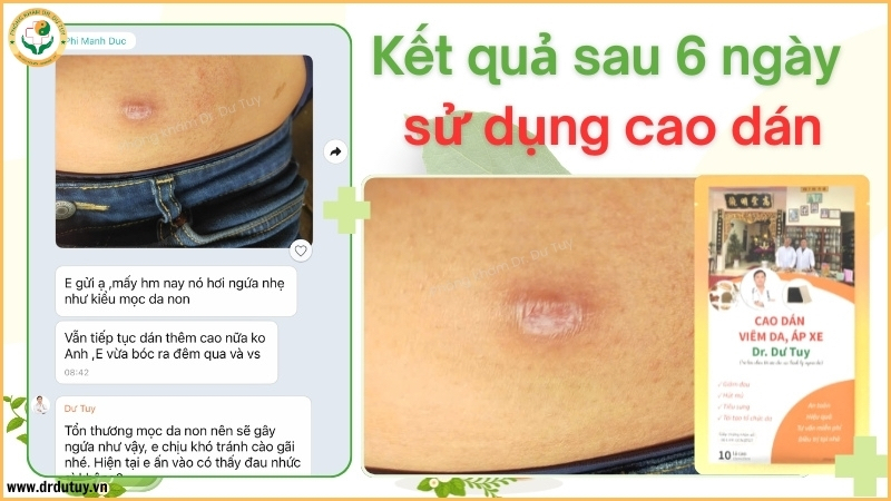 ket-qua-o-ap-xe-sau-6-ngay-theo-doi