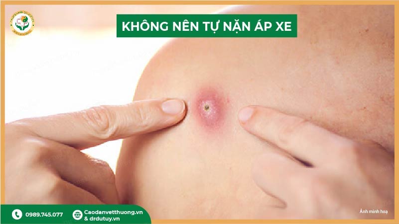 khong-nen-tu-nan-ap-xe-tai-nha