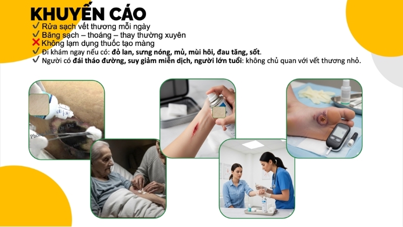 khuyen-cao-cham-soc-vet-thuong-dung-cach(1)