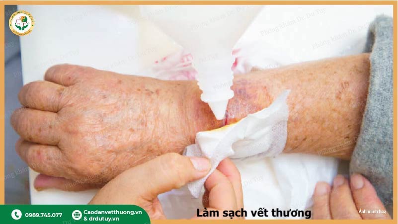 lam-sach-vet-loet-loai-bo-mo-chet