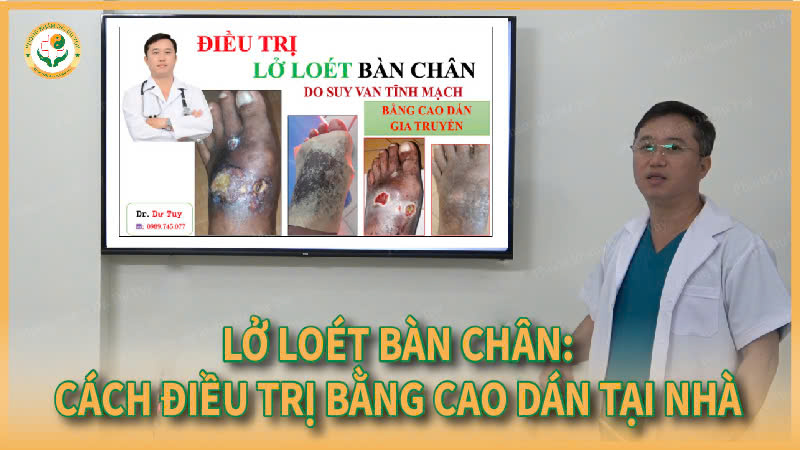 lo-loet-chan-do-suy-van-tinh-mach