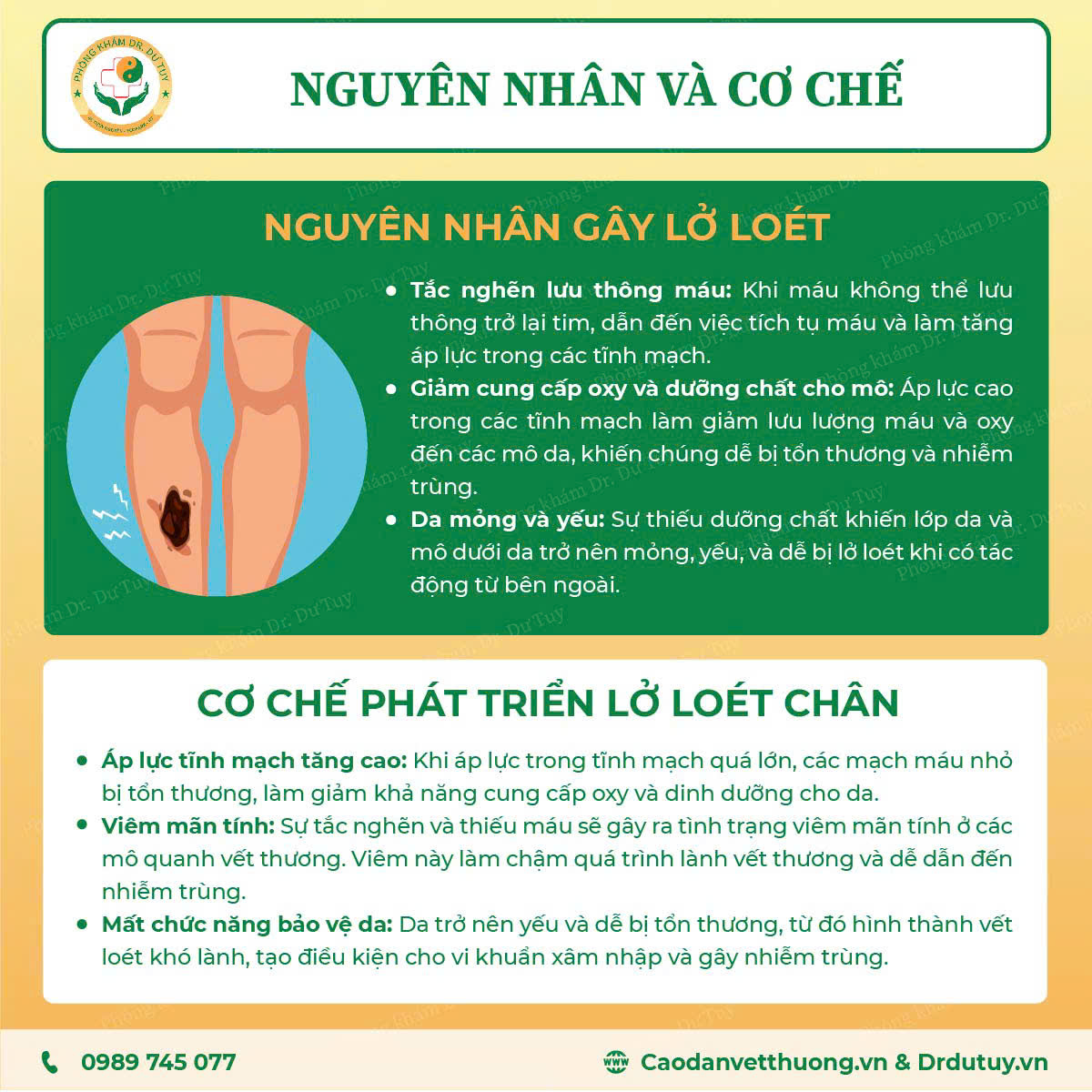 lo-loet-chan-do-suy-van-tinh-mach9