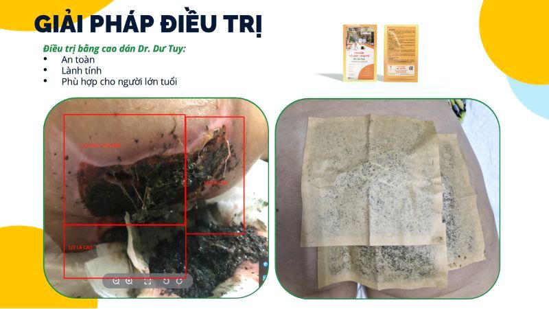 lo-loet-ti-de-nang-hoai-tu-vung-cung-cut