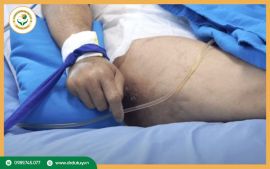 Loét Da Do Nằm Lâu Và Cách Phòng Tránh Hiệu Quả