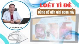 Lở Loét Vùng Cùng Cụt Ở Người Già Nằm Lâu: Đừng Chủ Quan Với Biến Chứng