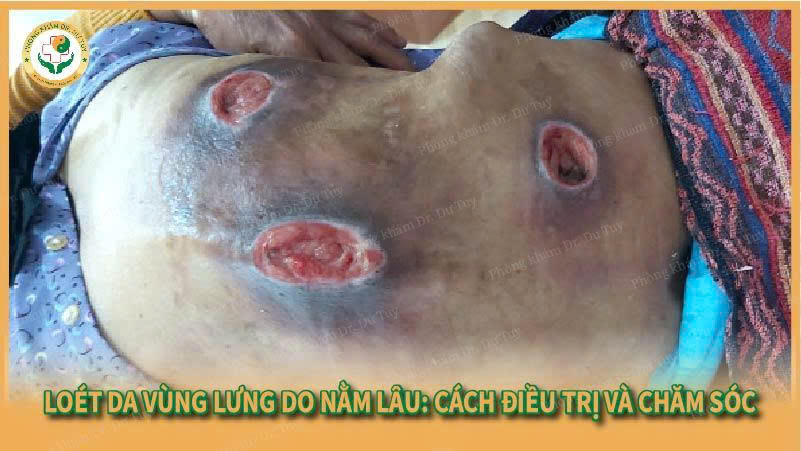 loet-da-vung-lung
