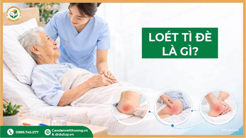 loet-ti-de-la-gi-o-nguoi-nam-lau