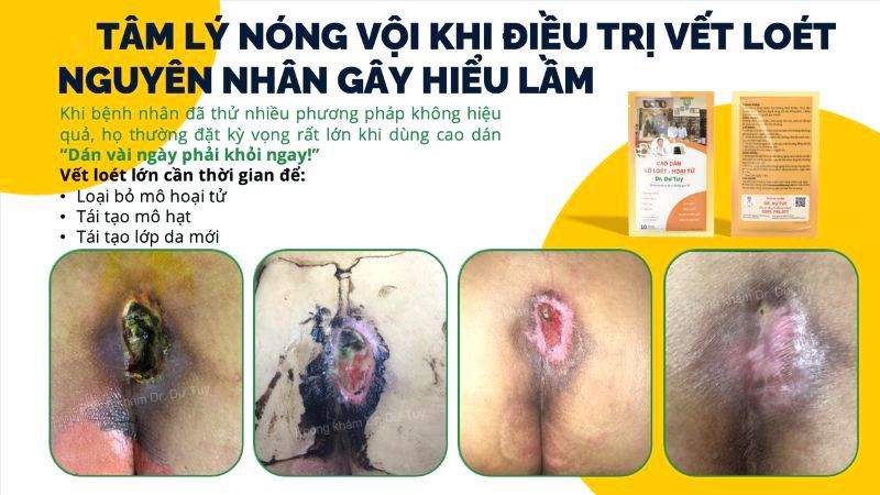 loi-khuyen-dieu-tri-vet-loet-ngoai-da-dung-cach