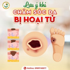 LƯU Ý KHI CHĂM SÓC DA BỊ HOẠI TỬ