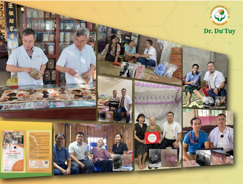 miếng dán trị lở loét da vùng cùng cụt