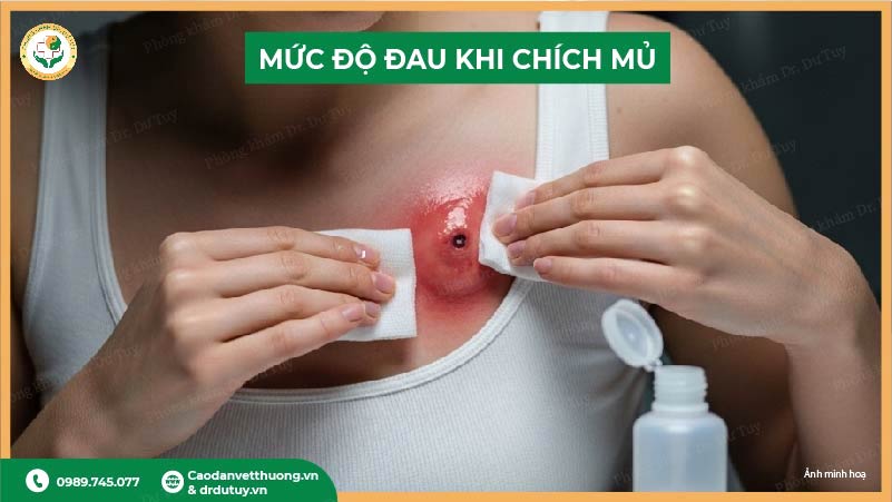 muc-do-dau-khi-chich-mu-ap-xe