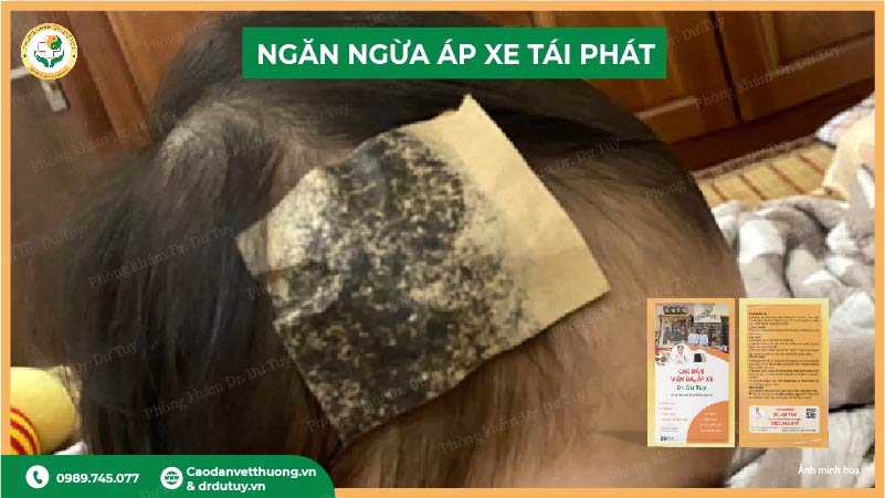 ngan-ngua-ap-xe-tai-phat