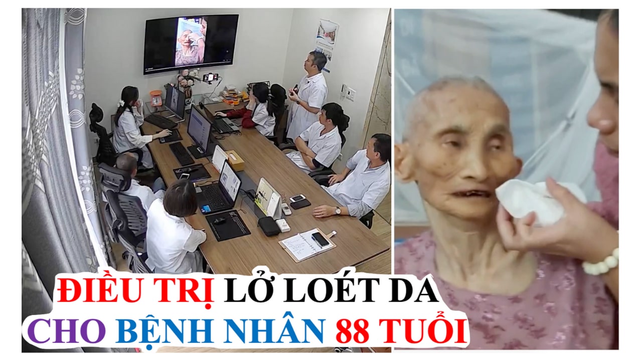 nguoi-gia-nam-lau-bi-loet-dieu-tri-khoi-lo-loet-do-nam-lau-nho-cao-dan-gia-truyen