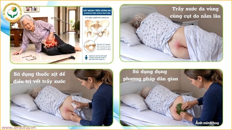 nguyen-nhan-loet-vung-cung-cut-nguoi-gia-nam-lau