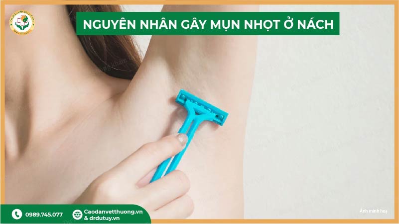 nguyen-nhan-mun-nhot-nach-cao-long