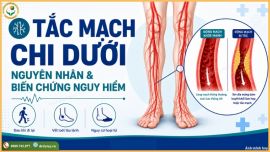 Tắc mạch chi dưới: Nguyên nhân, biến chứng và cách nhận biết