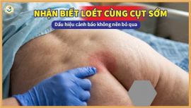 Cảnh báo: Nhận biết sớm loét vùng cùng cụt trước khi biến chứng