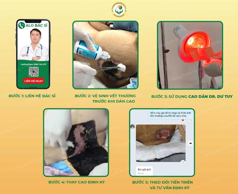 nhiem-trung-vet-mo-7