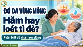 Cách Phân Biệt Loét Tì Đè Cùng Cụt Với Hăm Da Bệnh Nhân Lằm Lâu