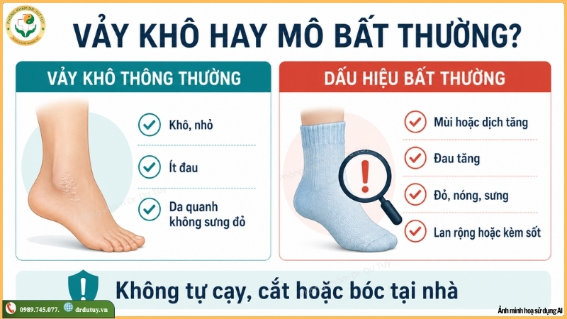 phan-biet-vay-kho-va-mo-hoai-tu