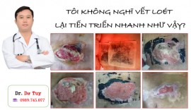 PHÒNG VÀ ĐIỀU TRỊ LOÉT DO TỲ ĐÈ