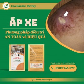 Phương pháp điều trị áp xe da hiệu quả