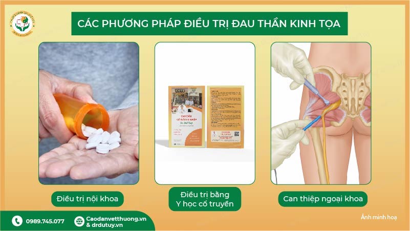 phuong-phap-dieu-tri-dau-than-kinh-toa-noi-khoa-y-hoc-co-truyen