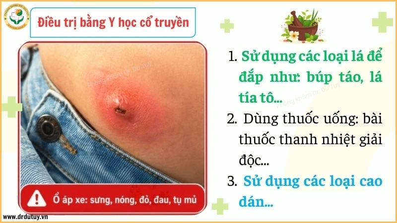 phuong-phap-y-hoc-co-truyen-ho-tro-ap-xe