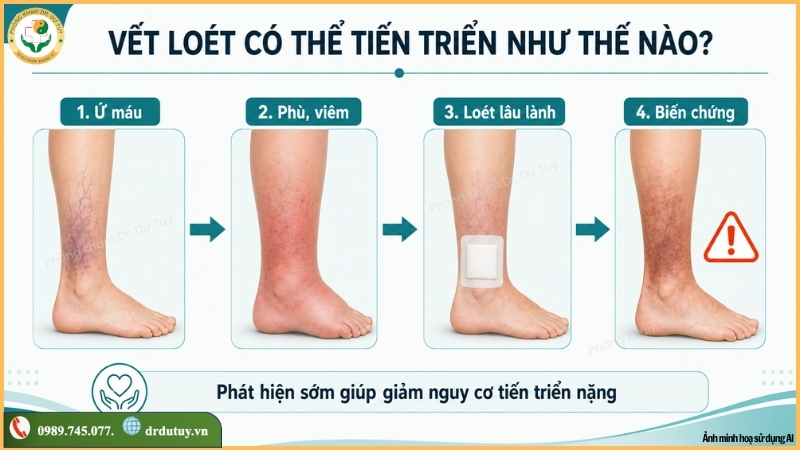 qua-trinh-vet-loet-chan-tien-trien