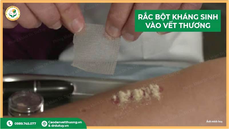 rac-bot-khang-sinh-len-vet-thuong