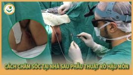 Rò Hậu Môn Bị Tái Phát? Nguyên Nhân Và Giải Pháp Hiệu Quả