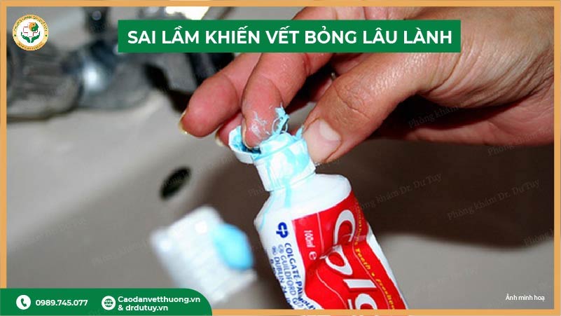 sai lầm chữa bỏng tại nhà