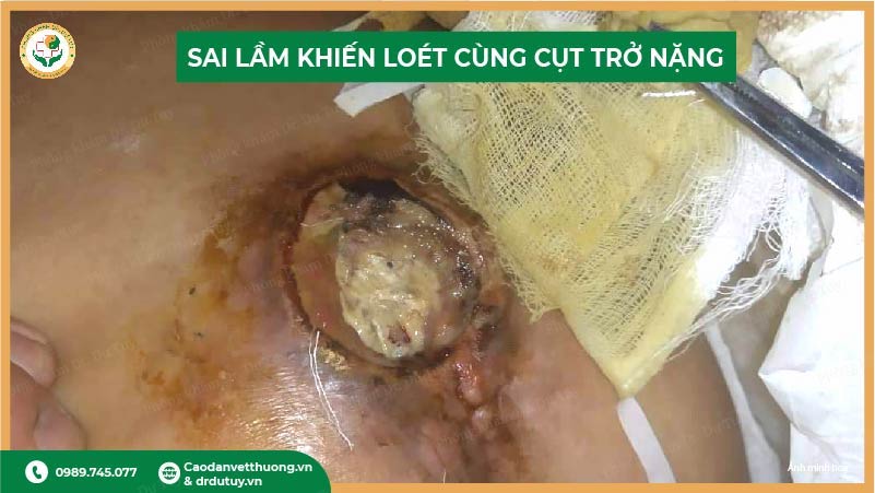 sai-lam-khien-loet-cung-cut-tro-nang