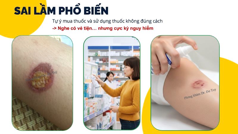 sai-lam-pho-bien-tu-mua-thuoc-tri-vet-thuong