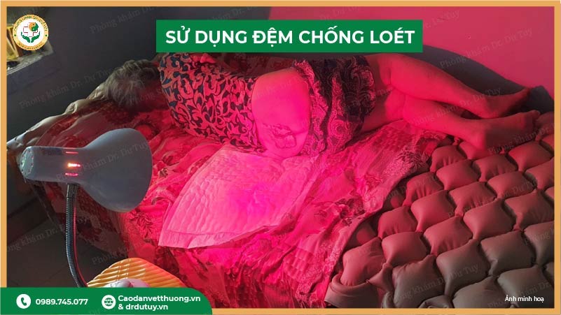 su-dung-dem-chong-loet-vung-cung-cut