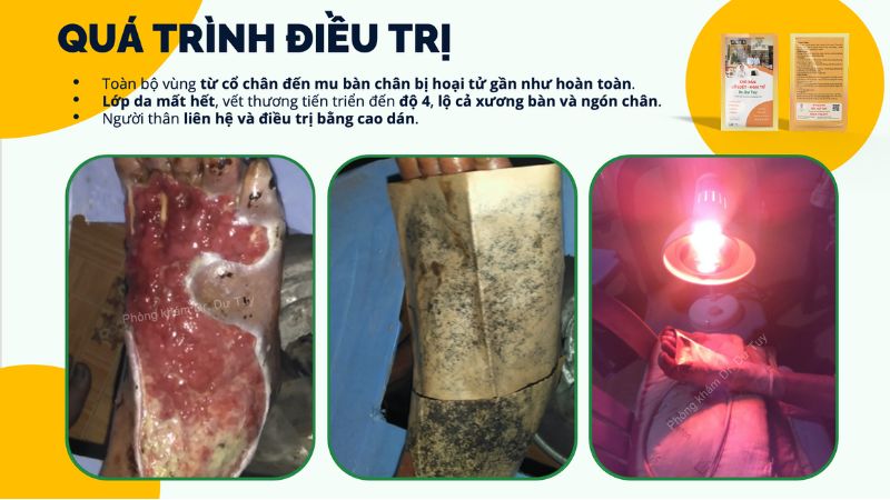 sức khoẻ sau thiên tai
