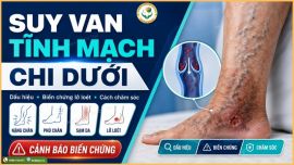 Theo Dõi Ca Lâm Sàng Điều Trị Áp Xe Ngoài Da Bằng Cao Dán 6 Ngày