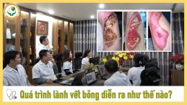Bao Lâu Thì Vết Bỏng Lành?