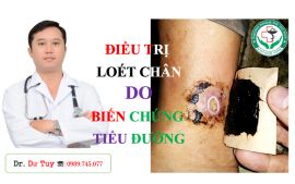 Điều trị hoại tử da cho bệnh nhân bị tiểu đường tại Tuyên Quang