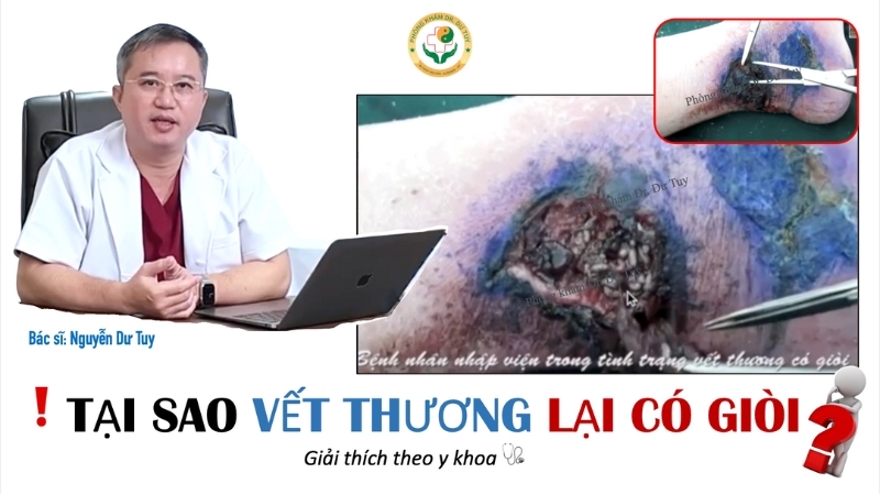thuoc-xit-vet-thuong-co-tot-khong