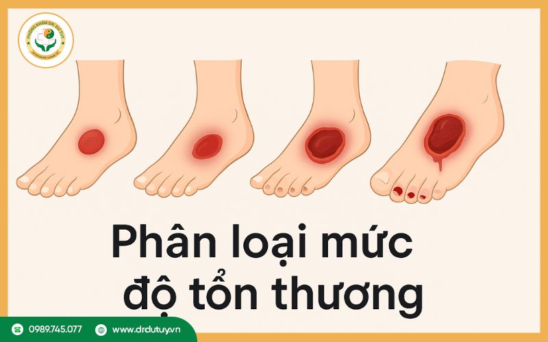 tieu-duong-bi-loet-chan3