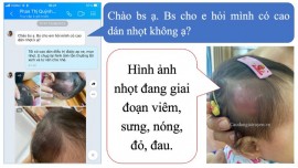 Trẻ bị mụn nhọt vùng đầu phải làm sao?