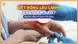 Vết bỏng lâu lành phải làm sao? Nguyên nhân và cách xử lý đúng