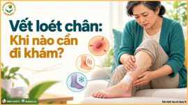 Loét chân khi nào là nguy hiểm? Dấu hiệu đỏ cảnh báo bạn cần gặp bác sĩ ngay