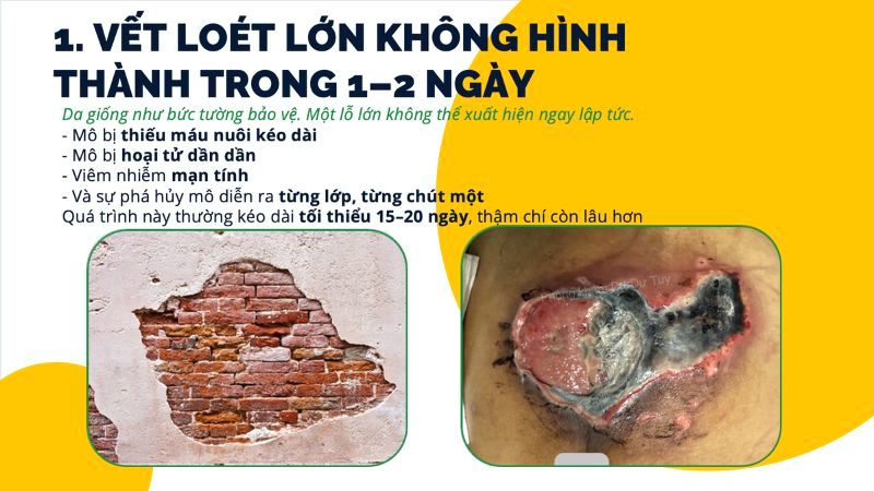 vet-loet-lon-mo-hoai-tu-thieu-mau-nuoi-keo-dai