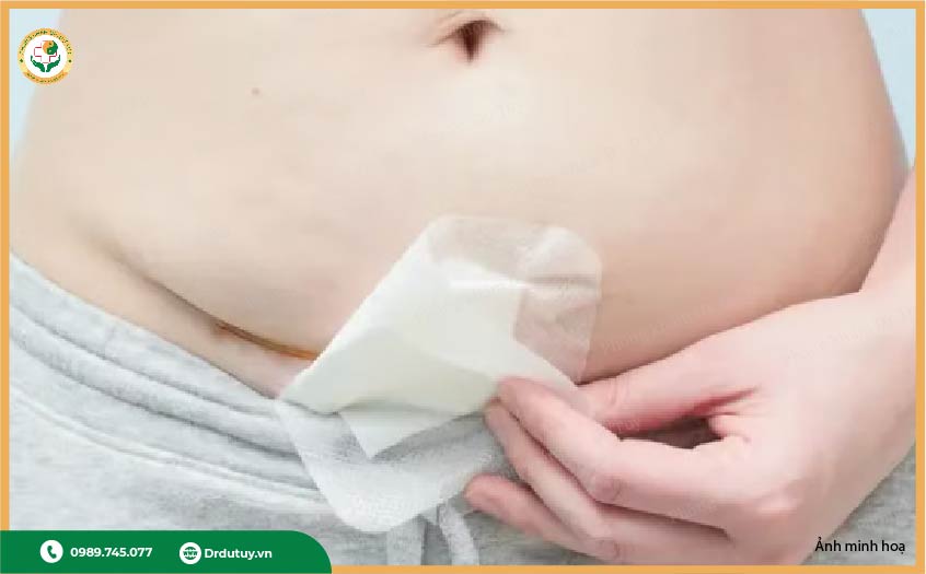 vết mổ rỉ dịch