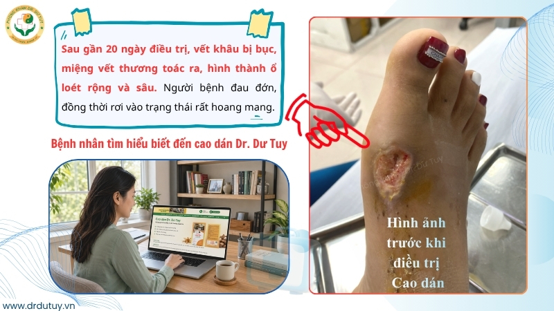 vet-thuong-ban-chan-bi-loet-sau-tai-nan