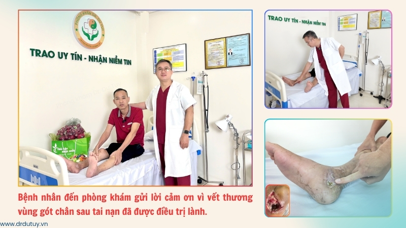 vet-thuong-got-chan-sau-tai-nan-da-duoc-dieu-tri-lanh