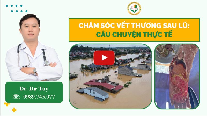 vết thương hoại tử
