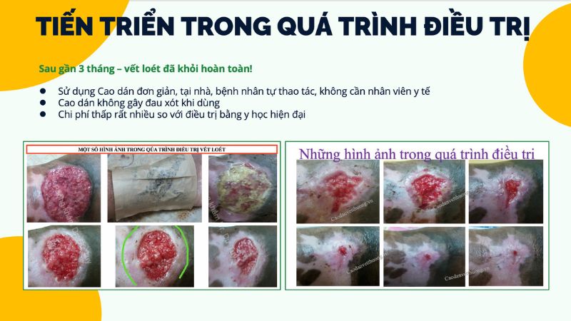 vết thương lâu lành